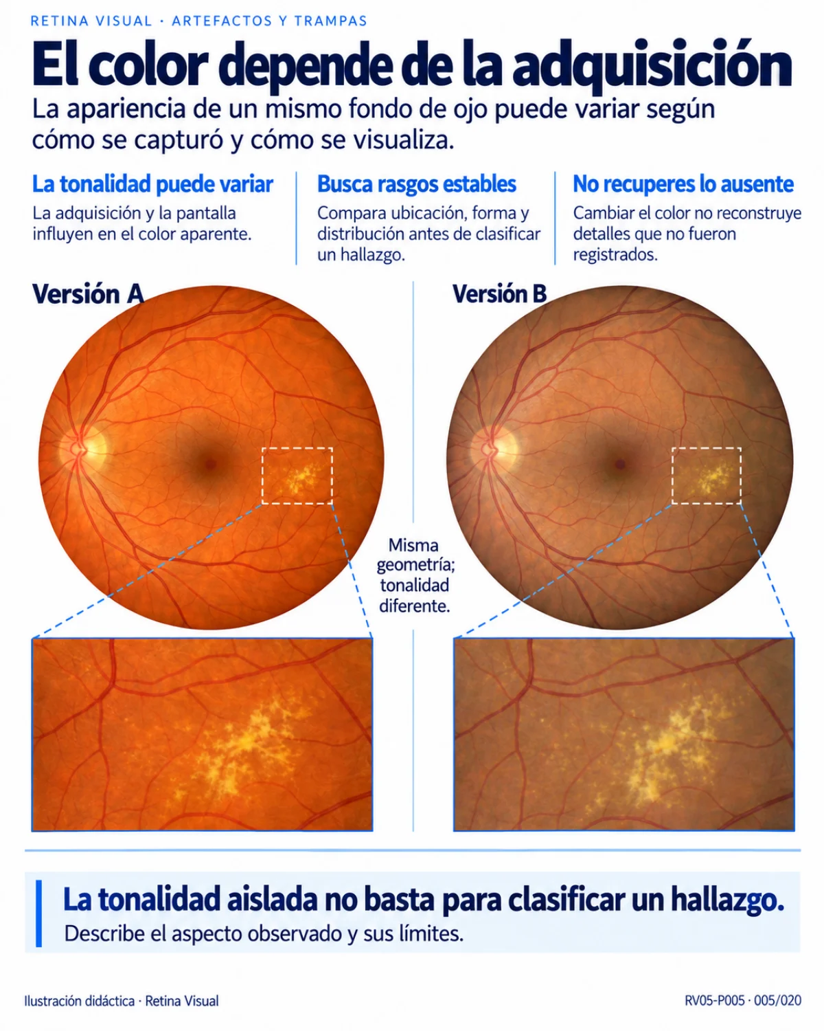Muestra del material de Retina: Artefactos · límites de la imagen.